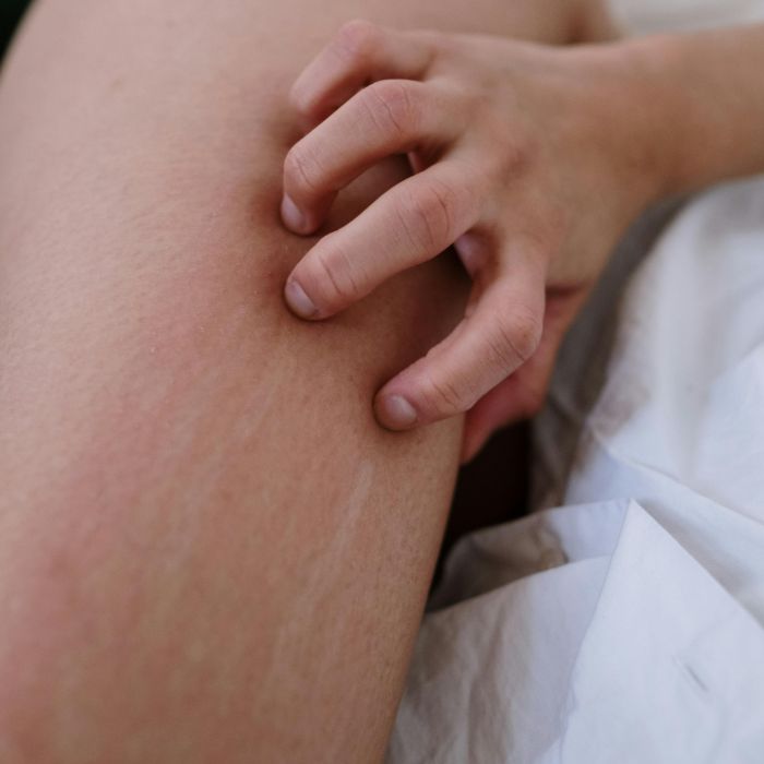 When Your Skin Writes Its Own Story