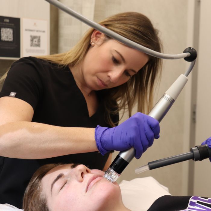 Comparing Trending Lasers to Advanced Dermatology’s Laser Treatments