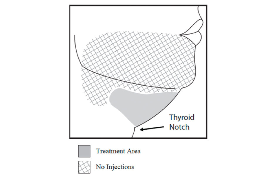 kybella-4
