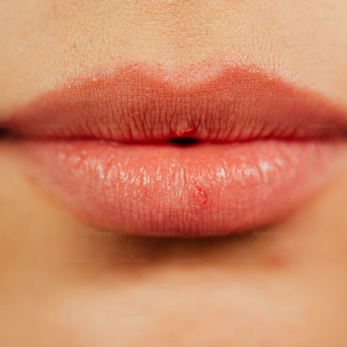 What Is A Lip Flip?