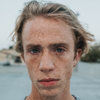 Sun Damage Over Time