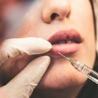 After BOTOX® for Years – When Do I Add Injectable Fillers to My Treatment Plan