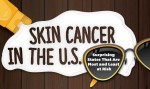 Which States Have the Highest Rates of Skin Cancer and Melanoma?
