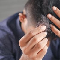 Alopecia – What is it and What Does Treatment Look Like?