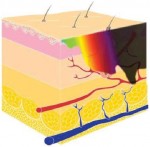 Understanding Lasers, Radiofrequency, IPL and Other Energy Based Devices