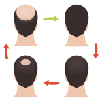 Enhancing Hair Growth