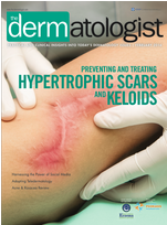Preventing & Treating Hypertrophic Scars & Keloids Fall/Winter Newsletter 2016